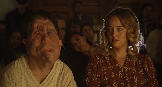 Adam Pearson and Jess Weixler in a scene from <i>Chained for Life</i>, courtesy Kino Lorber